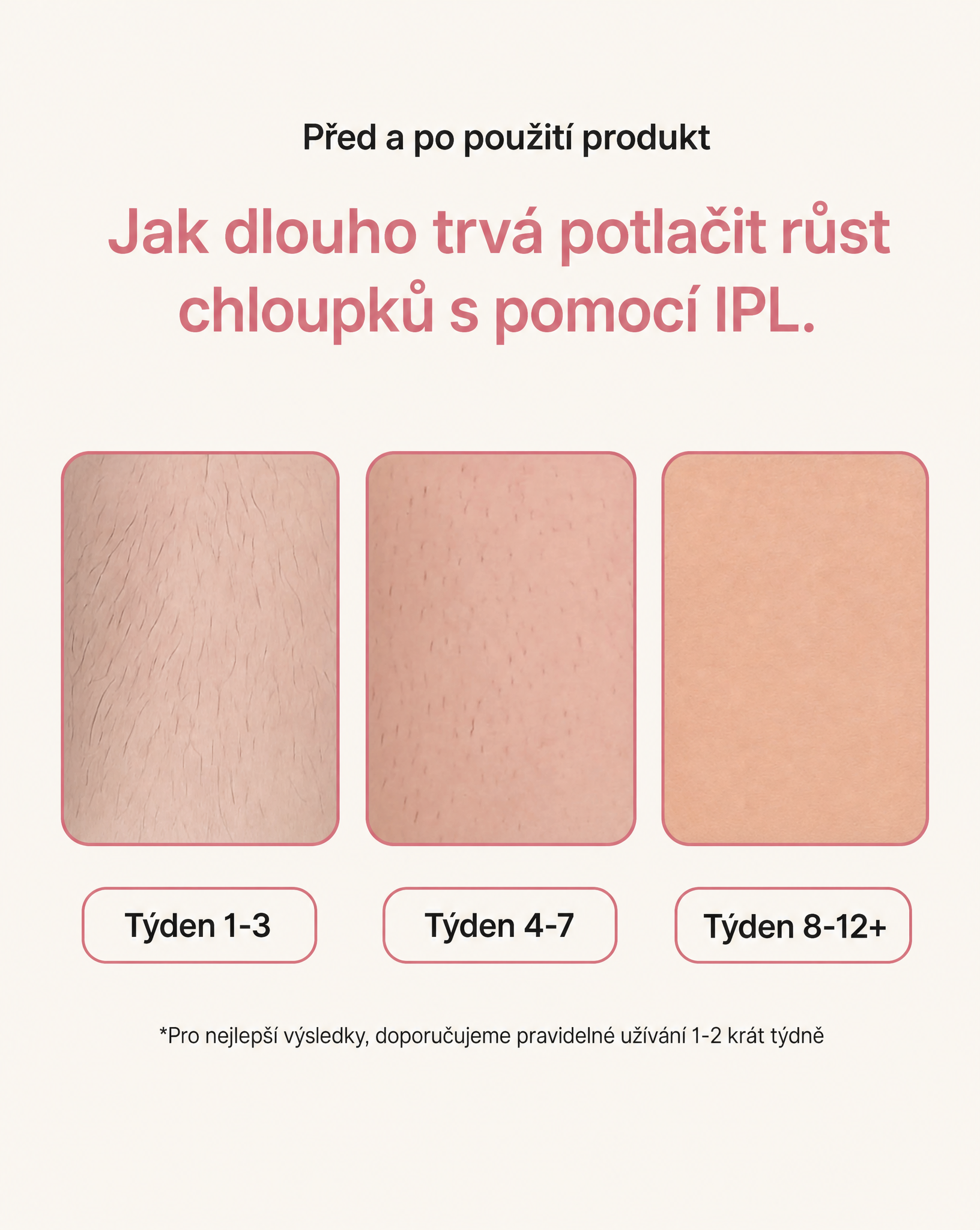 LAELUNA IPL - 5 stupňů intenzity, 900 000 záblesků