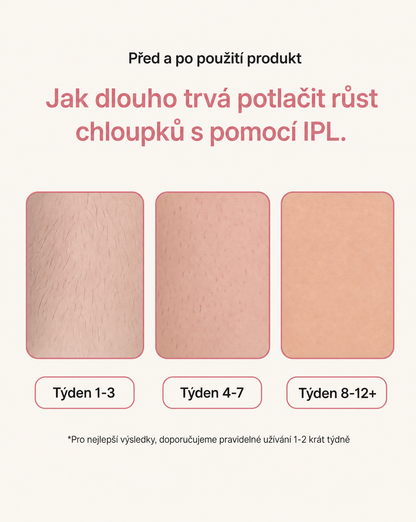 LAELUNA IPL - 5 stupňů intenzity, 900 000 záblesků