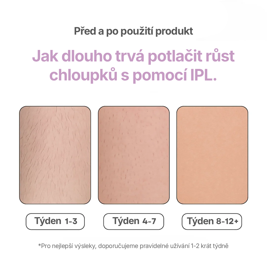 LAELUNA: IPL Laserový Odstraňovač Chloupků